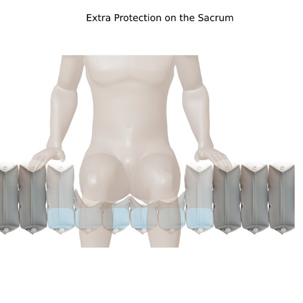 36 Inch Pro-Care Optima Systemwith Battery